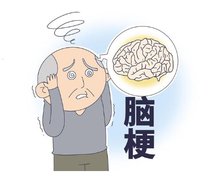 脑梗的症状都有哪些前期症状，经常感觉头晕的厉害，怀疑是不是脑梗