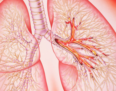 支气管炎的症状表现在哪些方面，支气管炎常见的三种症状