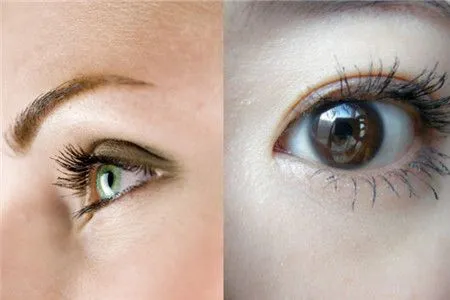 眼皮浮肿是什么原因引起的？眼皮浮肿的常见原因