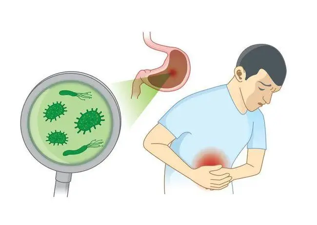 幽门螺旋杆菌感染有哪些症状，幽门螺旋杆菌的表现症状