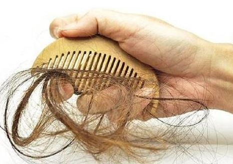 脱发严重是什么原因引起的，了解自己为什么脱发