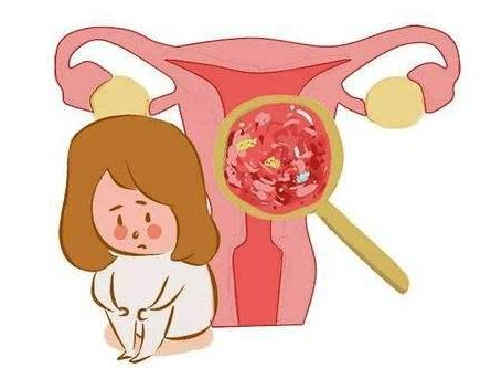 子宫肌瘤是什么原因导致的，咨询下子宫肌瘤的原因有哪些