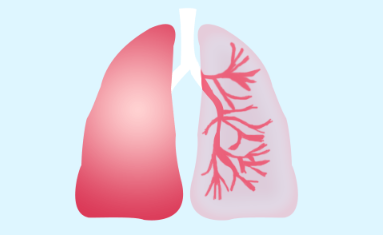 肺癌晚期最怕三个征兆，肺癌晚期怎么减少痛苦