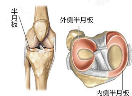 半月板损伤怎么治疗比较好得快，膝关节半月板损伤症状