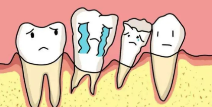 牙齿松动有什么办法恢复?介绍五个简单方法,快速恢复